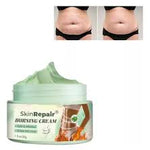 SKINREPAIR CREMA ANTI ESTRÍAS